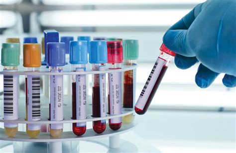 Blood Sample Collection Tubes, Colors Ultimate Guide | Healthcare Business Club