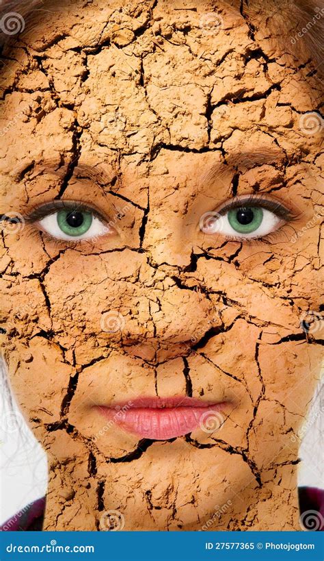 Cracked Skin Royalty Free Stock Photo - Image: 27577365