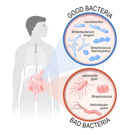 Gut feelings: what happens when your microflora is out of balance ...