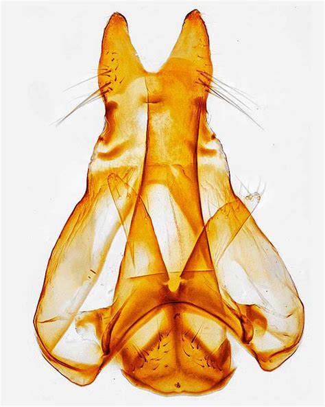 Moth Photographers Group – Genitalia – 420791 – 1878 – Xenolechia ontariensis