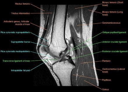 ABC Radiology Blog: Knee Joint