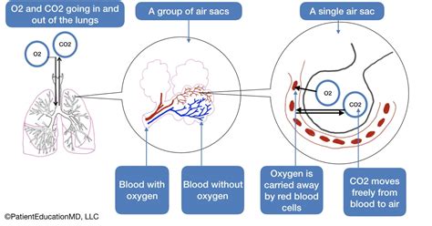 CO2 Buildup in Lungs: Symptoms, causes, and treatment ...