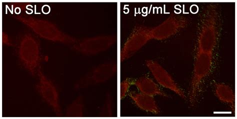 Streptolysin Antibody (6D11) - BSA Free (NBP1-05126): Novus Biologicals