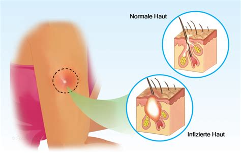 Health Condition : Symptoms, Causes, Treatment and More