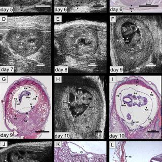 (PDF) Early detection and staging of spontaneous embryo resorption by ultrasound biomicroscopy ...