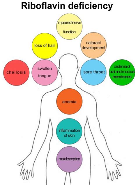 Riboflavin deficiency, causes, signs, symptoms, diagnosis & treatment