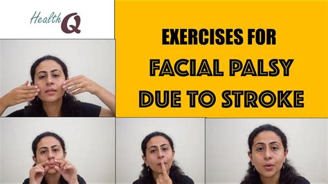 EXERCISES FOR STROKE RELATED FACIAL PALSY - YouTube