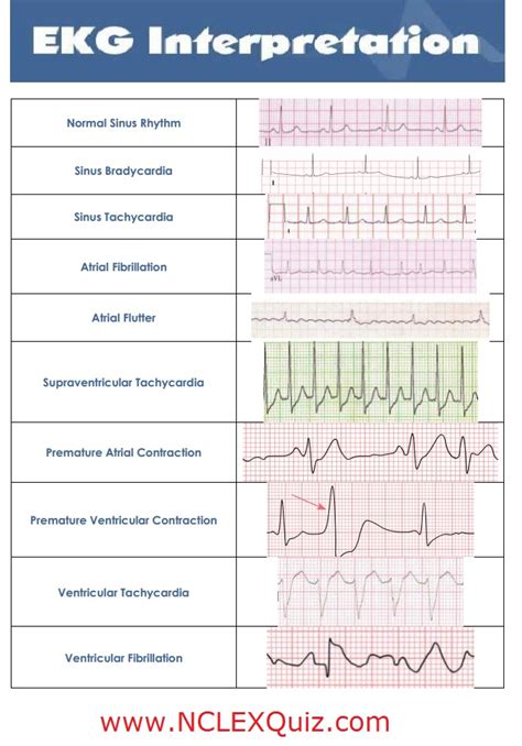 Your Cheat Sheet To Understanding The Chart | Images and Photos finder