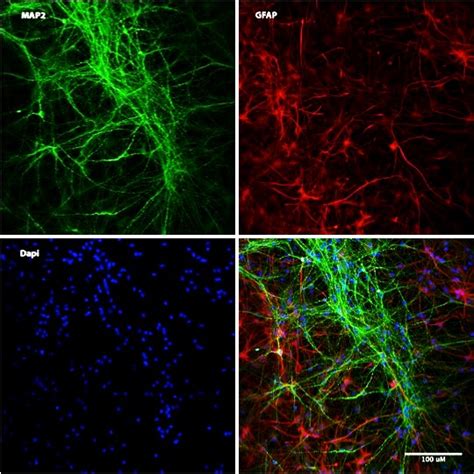 i-HNSC | Human iPSC-Derived Neural Stem Cells | Cell Applications