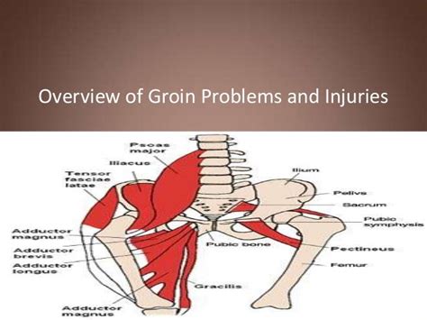 Groin Muscles Diagram Groin Muscles Diagram Diagram Of Groin | Images and Photos finder