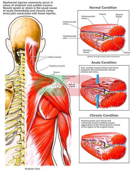 Pin on health & wellness