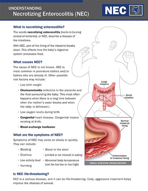 Necrotizing Enterocolitis (NEC) - NICU Parent Education Resources