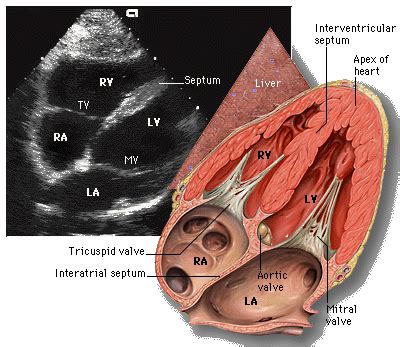 Ultrasound Leadership Academy: Basic Cardiac — EM Curious