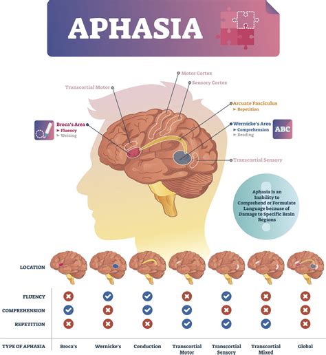 Brocas Aphasia