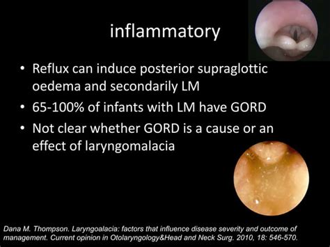 Laryngomalacia | PPT