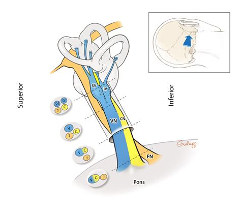 Internal auditory canal ct anatomy - applicationsnery