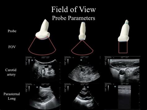 Internal Medicine Point of Care Ultrasound - IMPoCUS