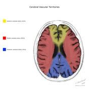 Brain arterial vascular territories | Radiology Reference Article ...