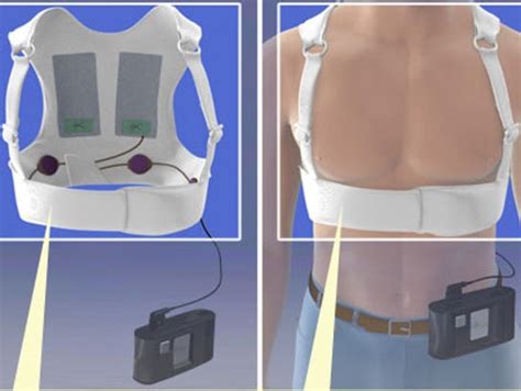 Defibrillator vest saves man from death 3 times