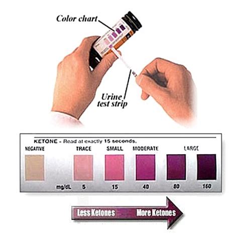 China Ketone Test Strips/Ketosis Test Strips - China Urine Test Strip, Urine Glucose Test Strip