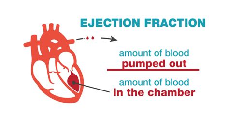 Ejection Fraction (EF) - Meds.wiki