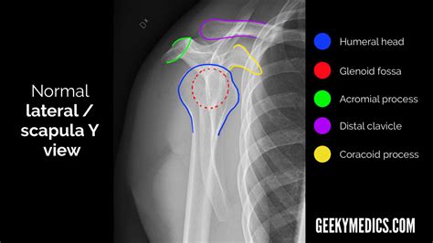 Shoulder X-ray Interpretation | Radiology | Geeky Medics