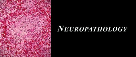 Neuropathology | Pathology, Microbiology And Immunology Education