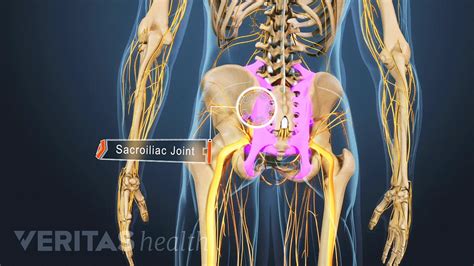 Share 145+ ankylosing spondylitis and heel pain - jtcvietnam.edu.vn