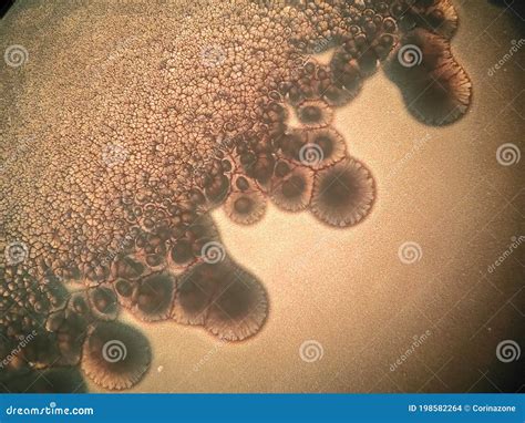 Microscope View of a Bacterial Colonies and Candida Albicans Stock Photo - Image of agar ...