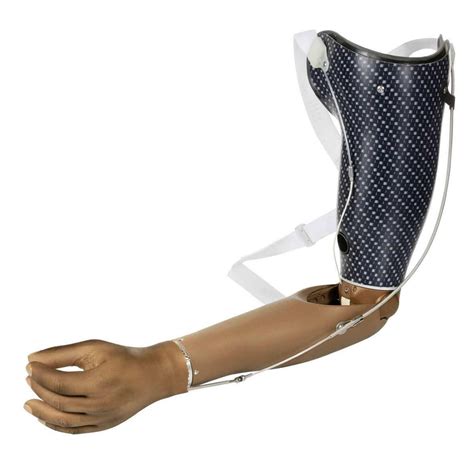 Care4you Functional Prosthetic Cable Operated (Body-Powered) Prosthesis Upper Arm, Rs 45000 ...