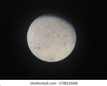 Crystallization Human Saliva Under Microscope Stock Photo 1738131068 ...