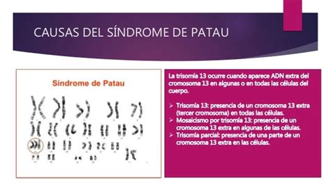 Sindrome de patau