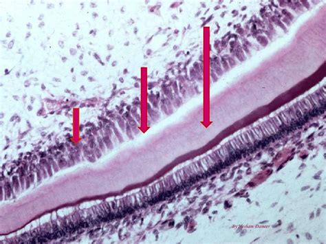 Histology of dentin