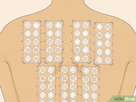 3 Ways to Read Allergy Skin Test Results - wikiHow