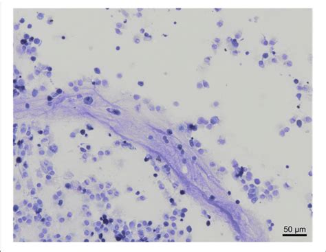 | Mucus observation in a bronchoalveolar lavage cytology from a healthy... | Download Scientific ...