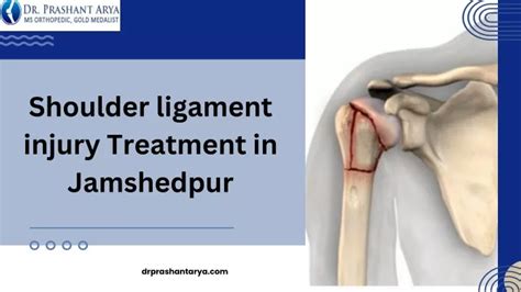 PPT - Shoulder ligament injury Treatment in Jamshedpur PowerPoint Presentation - ID:12953278