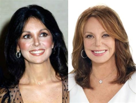 Marlo Thomas Plastic surgery for 76 year old!