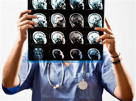 Cerebellar stroke: Symptoms, prognosis, treatment, and more