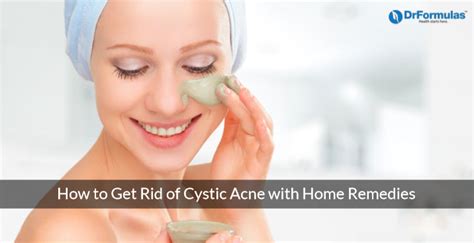 How to Get Rid of Cystic Acne with 8 Home Remedies – DrFormulas