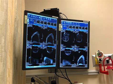 What is CRMO? (Chronic Recurrent Multifocal Osteomyelitis) - The Passport Kids Adventure Family ...