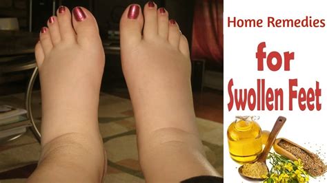 Top 5 Effective Home Remedies For Swollen Feet And Ankle Morpheme ...