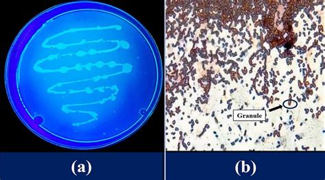 a Nile blue staining on plate b Sudan black stain showing black PHA... | Download Scientific Diagram