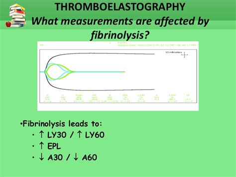 Thromboelastography