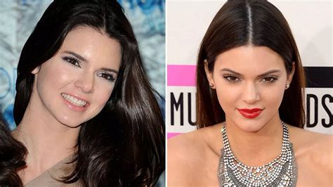 Has Kendall Jenner had a nose job? Reality star's thinner features ...