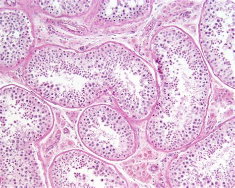 File:Testis histology 010.jpg - Embryology