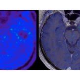 Single modality FMISO PET/MR imaging in a 65-year-old man with... | Download Scientific Diagram