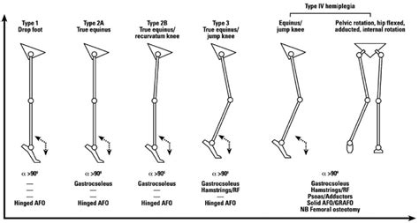 Gait patterns and management algorithm for unilateral spastic cerebral ...