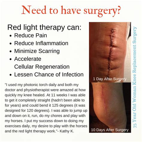 Red Light therapy applied to 10-day-old knee replacement surgical scar - Before & After | Red ...