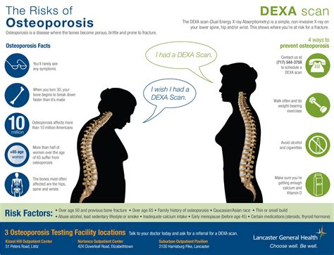 Learn osteoporosis facts, risk factors, and 4 ways to prevent osteoporosis. Lancaster General ...