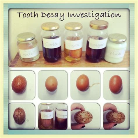 Pin by robert on Tooth decay (With images) | Kindergarten science fair projects, Science fair ...